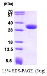 Human CBR1 protein. GTX67269-pro