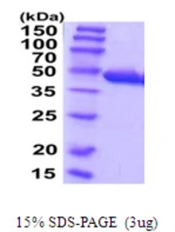 Human CCBL1 protein, His tag. GTX67271-pro