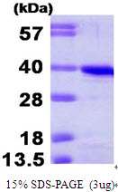 Human Cyclin H protein, His tag. GTX67276-pro