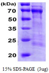 Human CDC25A protein, His tag. GTX67279-pro