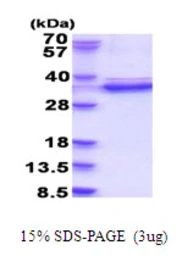 Human CDK2 protein, His tag. GTX67282-pro