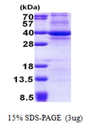 Human CDK3 protein, His tag. GTX67283-pro