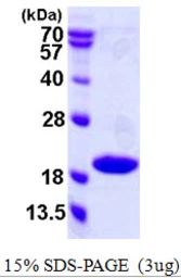 Human p18 INK4c protein, His tag. GTX67289-pro