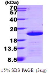 Human Centrin 2 protein, His tag. GTX67292-pro