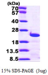 Human Centrin3 protein, His tag. GTX67293-pro