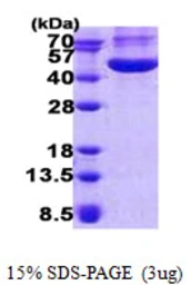 Human CHI3L1 protein, His tag. GTX67296-pro
