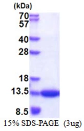Human CKS1 protein, His tag. GTX67301-pro