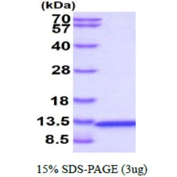 Human CKS2 protein, T7 tag. GTX67302-pro