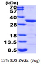 Human CLIC1 protein, His tag. GTX67305-pro