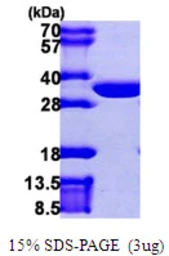Human CLIC2 protein, His tag. GTX67306-pro