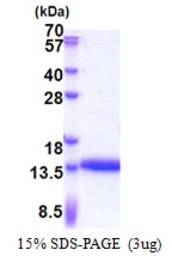 Human CRIP1 protein, His tag. GTX67316-pro