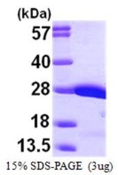 Human CRK protein, His tag. GTX67317-pro
