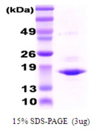 Human alpha A Crystallin protein. GTX67320-pro