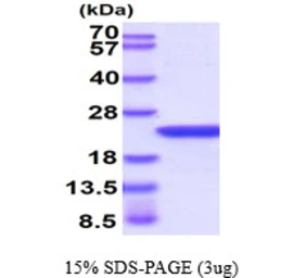 Human alpha B Crystallin protein. GTX67321-pro