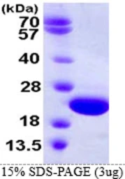 Human CRYGD protein, His tag. GTX67325-pro
