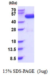 Human CSK protein, His tag. GTX67330-pro