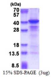 Human Casein Kinase 1 alpha protein, His tag. GTX67331-pro