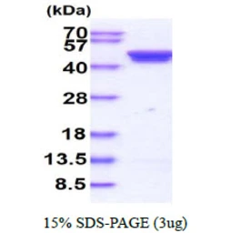 Human Casein Kinase 2 alpha protein, His tag. GTX67333-pro
