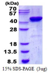 Human CSNK2A2 protein, His tag. GTX67335-pro