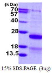 Human CSRP2 protein, His tag. GTX67337-pro