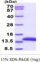 Human Cystatin A protein, His tag. GTX67338-pro