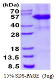 Human cleavage stimulation factor protein, His tag. GTX67340-pro