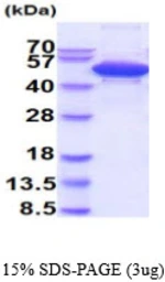 Human cleavage stimulation factor protein, His tag. GTX67341-pro