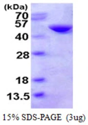 Human CTH protein, His tag. GTX67343-pro