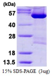 Human DARS protein, His tag. GTX67346-pro