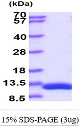 Human DBI protein, His tag. GTX67347-pro