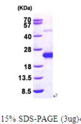 Human DCTD protein, His tag. GTX67349-pro