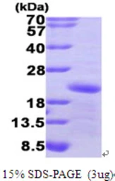 Human GADD45A protein, His tag. GTX67351-pro