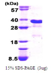 Human GADD153 protein, His tag. GTX67352-pro