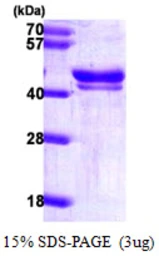 Human ICAD protein, His tag. GTX67354-pro