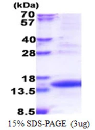 Human TIMM8A protein, His tag. GTX67355-pro
