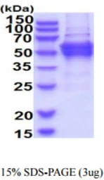 Human DPH2 protein, His tag. GTX67359-pro
