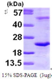 Human DR1 protein, His tag. GTX67360-pro