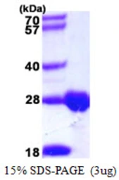 Human DTYMK protein, His tag. GTX67363-pro