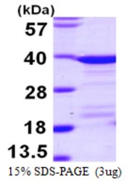 Human EEF1D protein, His tag. GTX67367-pro