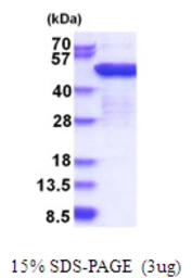 Human EEF1G protein, His tag. GTX67368-pro