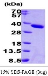 Human ESD protein, His tag. GTX67380-pro