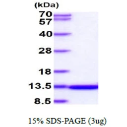 Human ILBP protein. GTX67387-pro