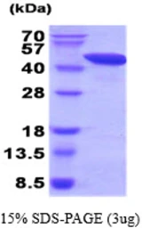 Human FEN1 protein. GTX67390-pro
