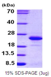 Human FGF12 protein, His tag. GTX67391-pro