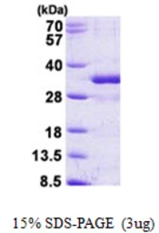 Human FGF14 protein, His tag. GTX67392-pro