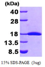 Human FHIT protein, His tag. GTX67393-pro