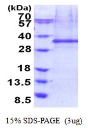 Human FHL2 protein, His tag. GTX67394-pro