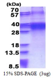 Human FHL3 protein, His tag. GTX67395-pro