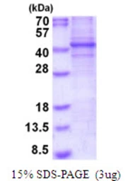 Human FRA2 protein, His tag. GTX67396-pro