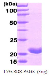 Human Ferritin Heavy Chain protein. GTX67397-pro